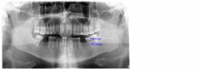 Radiologia moderna in endodontologie