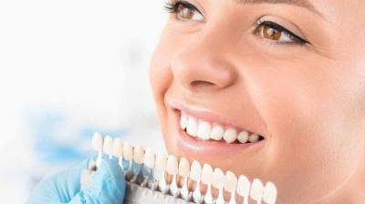 Cât costă albirea dentară și care sunt stereotipurile legate de această procedură stomatologică