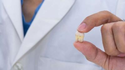 Distrugem miturile despre extracția dentară: care sunt prețurile și cum decurge perioada postextracțională