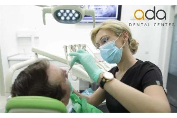Ada Dental Center - parodontologie1.jpg