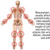 Artrita reumatoida – importanta exercitiului fizic