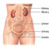 Cauze de vezica urinara hiperactiva