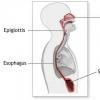 Perforatia esofagiana