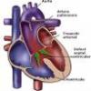 Tipuri de defecte congenitale ale inimii