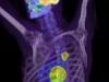 1872_rezultat_PET_CT.jpg