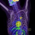 PET/CT – Diagnostic decisiv in oncologie PET/CT – Diagnostic decisiv in oncologie