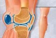articulațiile rănesc picioarele de la alergare artroza articulației umărului pentru a ameliora durerea