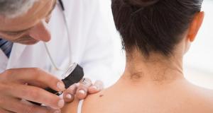 Cancerul de piele - ce inseamna si cum ne putem feri de acesta