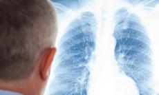 Curatarea plamanilor afectati de boala, fumat sau poluare