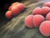 Neisseria_meningitidis.jpg