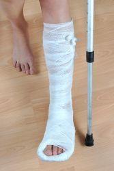 Primul ajutor in fractura piciorului