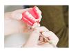 Rezectia apicala – metoda chirurgicala in terapia conservatoare endodontica