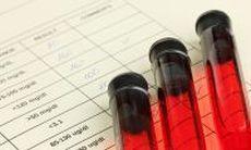 7 lucruri pe care medicul nu vi le explica despre analizele de sange