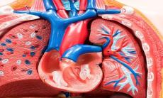 Ce este persistența de canal arterial? ne spune Dr. Cristian Bulescu, medic specialist chirurgie cardiovasculară