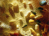 article_18_Septicemia.gif
