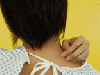 article_51_Urticariile.gif