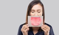 Candidoza orala - diagnostic si tratament