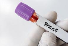 Intrebari esentiale pe care sa i le adresezi medicului despre celulele stem