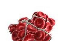 Pericolele formarii cheagurilor in vasele de sange