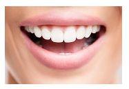 Dentcof - Variante pentru un zambet perfect. Fatete dentare. Fatete dentare no prep. Dentcof - Variante pentru un zambet perfect. Fatete dentare. Fatete dentare no prep.