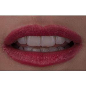Dentcof - Igienizare Profesionala Dentcof - Igienizare Profesionala