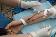 dureri articulare cu hemodializă lacuri pentru tratamentul artrozei