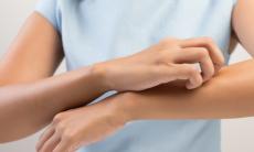 Factori care influenteaza aparitia eczemelor