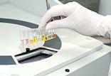 Factori de risc in dezvoltarea cancerului Factori de risc in dezvoltarea cancerului