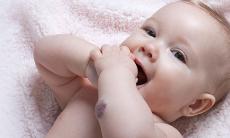 Ce trebuie sa stim despre hemangiomul infantil?