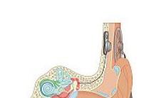 Implantul cohlear - electrozi la nivelul urechii interne