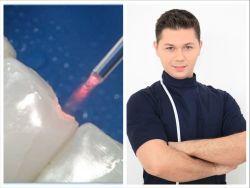 Laserul Dentar - Inovatia Medicala pentru care mergi de placere la stomatolog - discount la prima interventie cu Laserul Dentar la Dental One 50% Laserul Dentar - Inovatia Medicala pentru care mergi de placere la stomatolog - discount la prima interventie cu Laserul Dentar la Dental One 50%