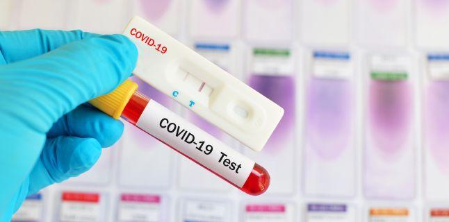 MedLife: Testele rapide antigen nu reprezinta un instrument fiabil pentru diagnosticul COVID-19. Aproape jumatate din rezultate sunt fals negative