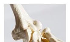 Osteoporoza, o problema majora de sanatate