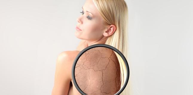 Ce boli poate indica pielea uscata?