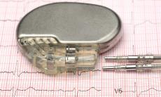 Stimulatoarele cardiace si defibrilatoarele salveaza vieti in moduri diferite