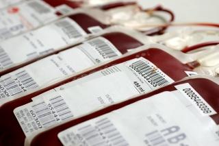 Situatia unitatilor sanitare publice fara unitati de transfuzie sanguine autorizate Situatia unitatilor sanitare publice fara unitati de transfuzie sanguine autorizate