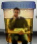 Ce dezvaluie urina despre sanatatea dumneavoastra