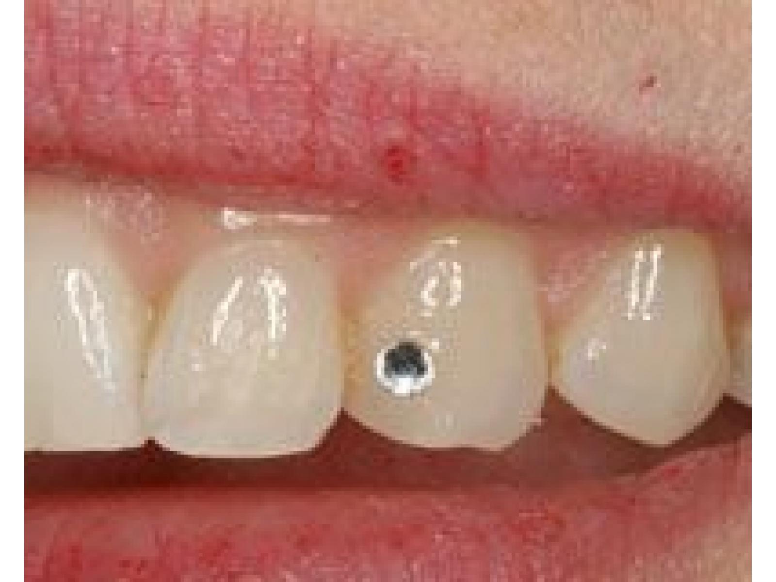 Clinica Stomatologica Best Dental - stras_dentar1.jpg