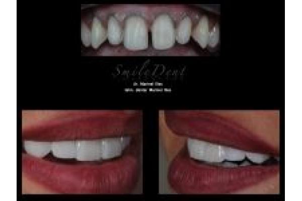 Smile Dent - cojoc.018.jpg