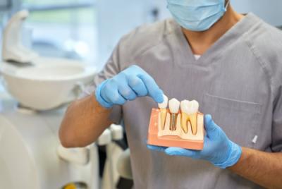 Cine poate beneficia de implant dentar