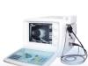 Ecograf Ocular MEDX 2100 A/B SCAN 