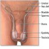 Tulburari ale sistemului reproducator la barbat: afectiuni testiculare