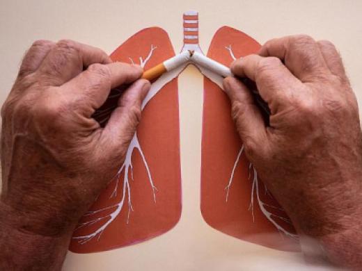 Rolul fumatulul si a expunerilor profesionale in aparitia cancerului pulmonar