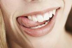 Varicoză în cavitatea orală. Varicozitate în cavitatea bucală