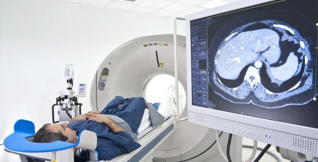 Tomografie computerizată cu contrast abdominal - Icter 