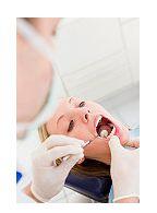 Coroane de portelan - Intrebari frecvente despre puntile dentare