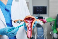 Miomectomia - interventia de indepartare a fibroamelor uterine