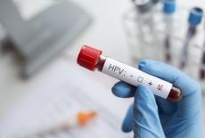Cum se manifesta infectia cu HPV la barbati