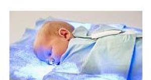Icterul la nou nascuti (hiperbilirubinemia)