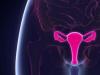 Ovarectomia (chirurgia indepartarii ovarelor)